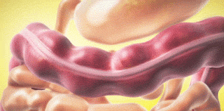 Yeşil Ceviz Kabuğu